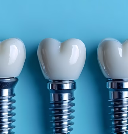 Behandeling Implantologie
